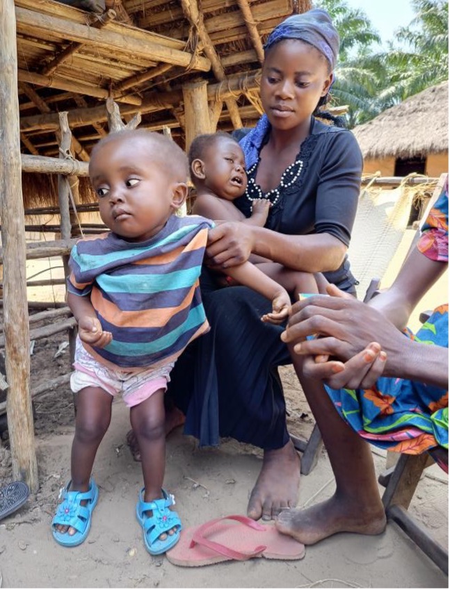 Mother with Two Children in DRC A mother in the Democratic Republic of Congo cares for her two children, highlighting the importance of protecting the next generation through polio vaccination.