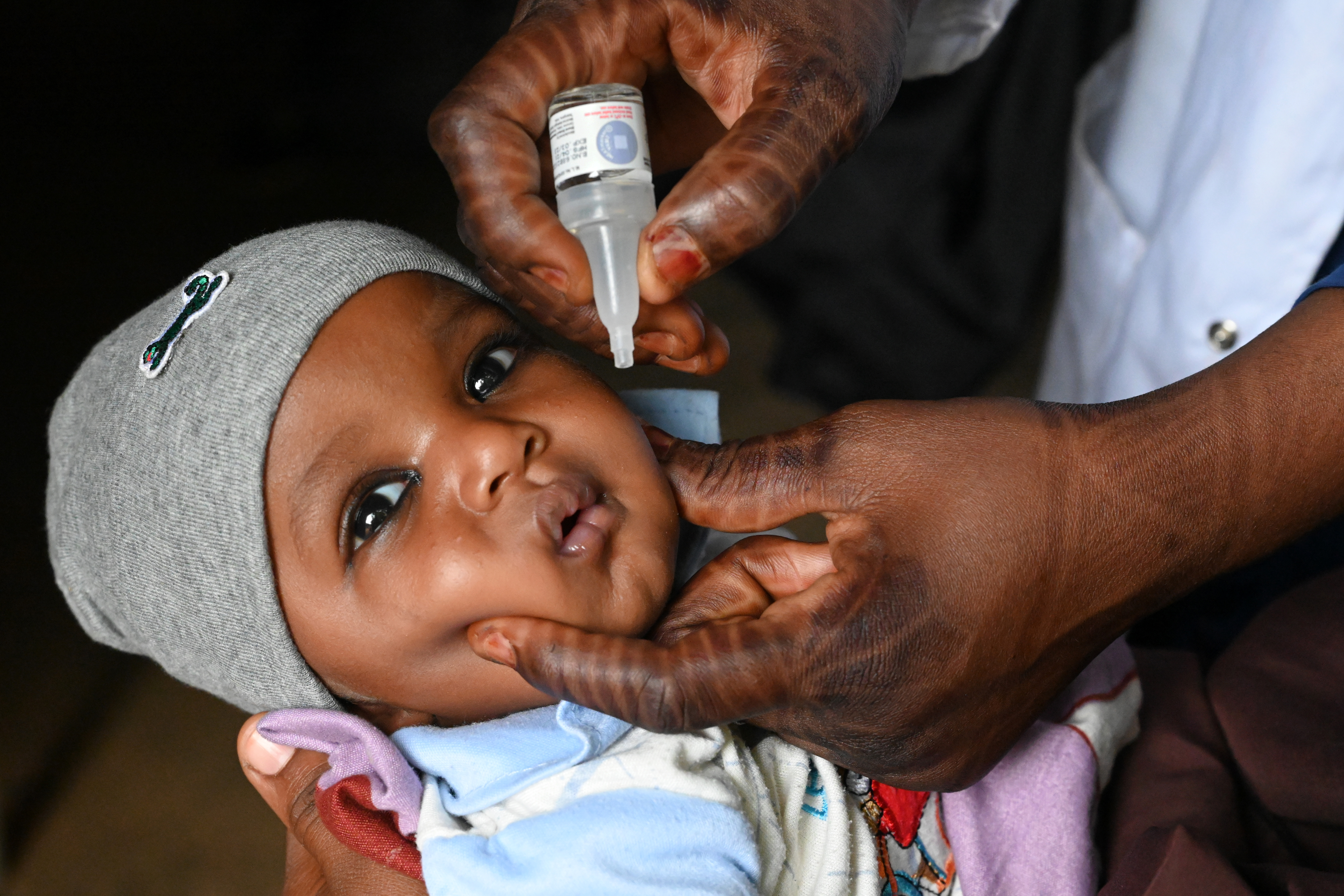 A baby taking the polio vaccine